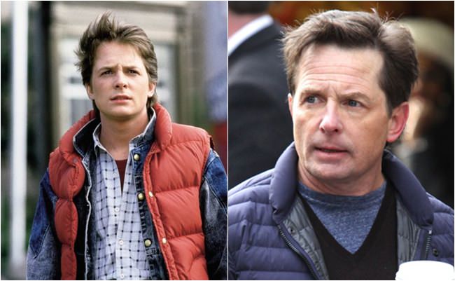 Antes e depois michael j fox