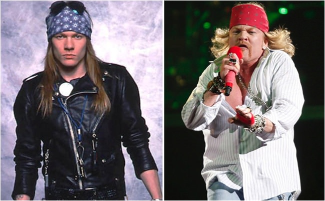 antes e depois axl rose