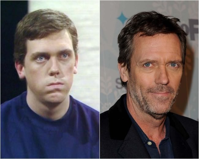 hugh laurie antes e depois