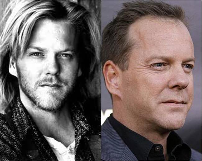 kiefer sutherland antes e depois