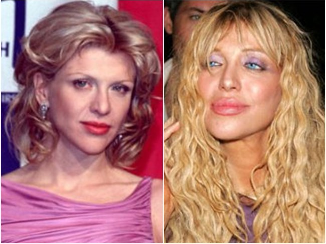 preenchimento boca courtney love