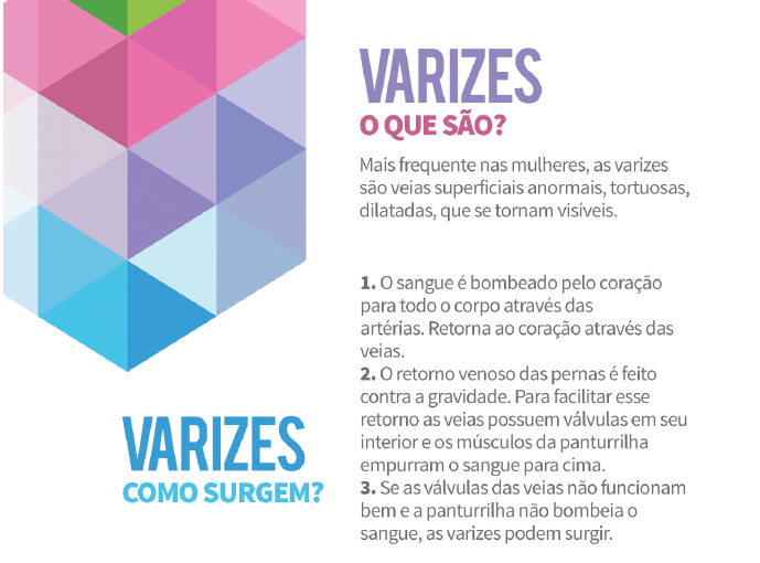 varizes1